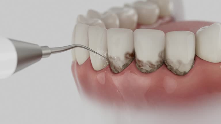 Reliable Tooth Extraction contractor in Phillipsburg, GA by Smile Center Dentistry